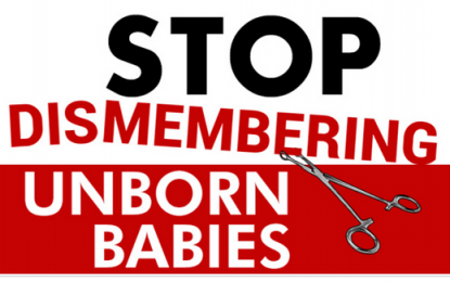 Twenty-two states join fight for Alabama’s dismemberment abortion ban