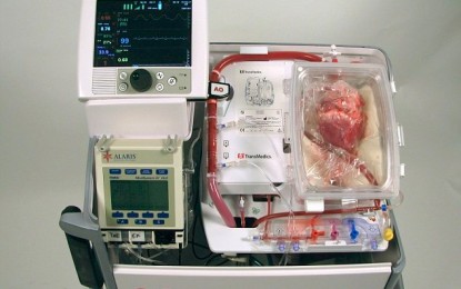 ‘Dead hearts’ Transplanted into Living Patients in Surgical Breakthrough
