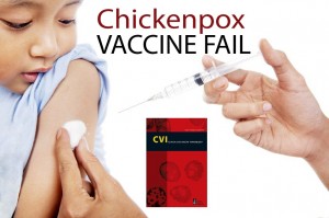 Mandatory chickenpox_vaccine