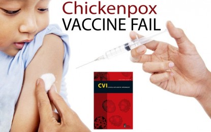 Mandatory Chickenpox Vaccination Increases Disease Rates, Study Shows