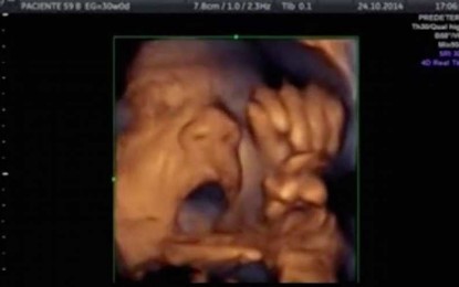 Video Shows Unborn Baby at 18 Weeks ‘Singing’ to Music in Groundbreaking Study