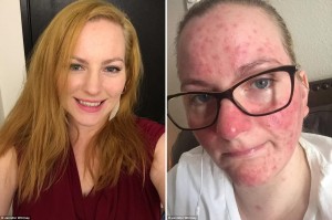 Mother claims - Jennifer Whitney before and after flu shot