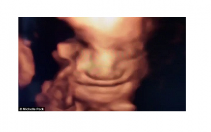 Amazing 4D Ultrasound Scan Shows Unborn Baby Smiling
